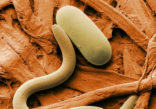 What is sem and its types?